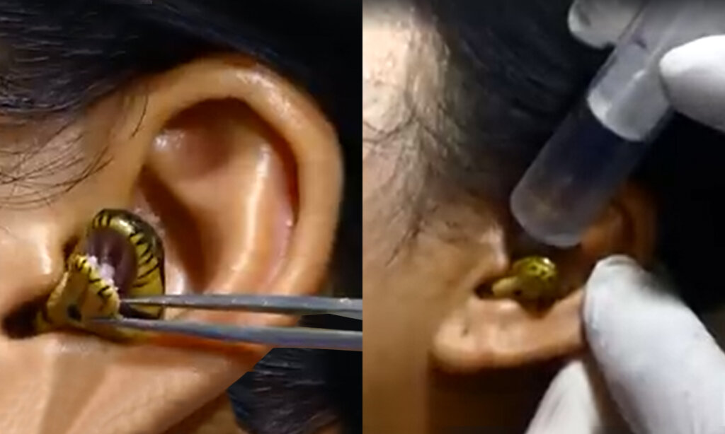 snake ear 1