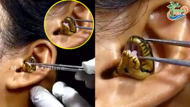 snake in ear 1